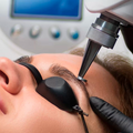 ELIMINACIÓN DE MICROBLADING 3 SESIONES